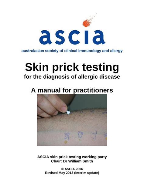 Skin Prick Testing Guide for Diagnosis of Allergic Disease.